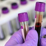 Maharashtra Shocker: 4 Thalassemic Children Test HIV Positive After Blood Transfusion in Nagpur